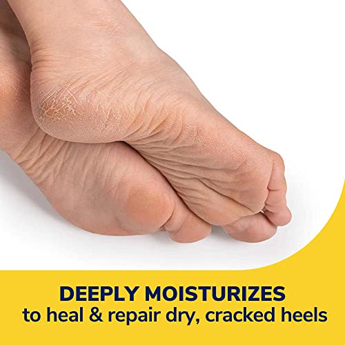 Dr. Scholl's Severe Cracked Heel Repair Restoring Balm 2.5oz, with 25% Urea for Dry, Cracked Feet, Heals and Moisturizes for Healthy Feet